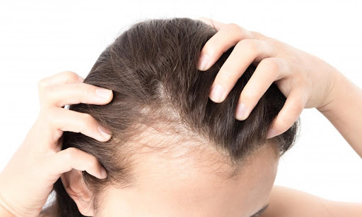Secondary Causes of Hair Thinning and Loss