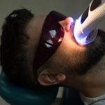 Invisalign Work